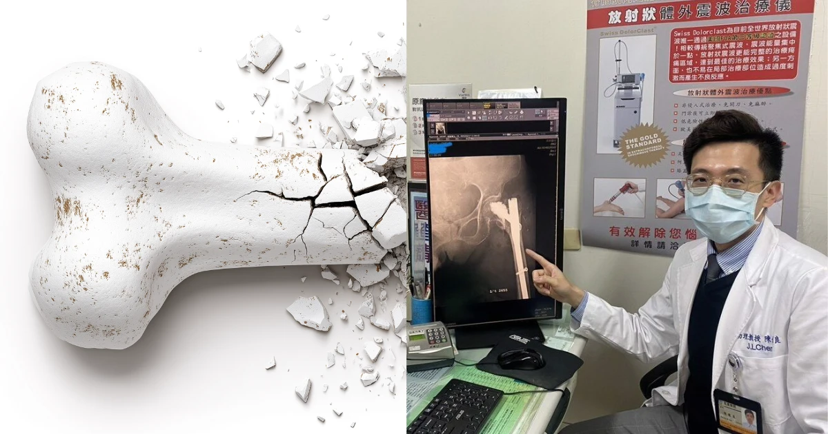 媒體報導 - test1 精選圖片