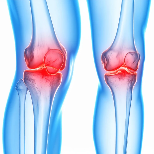 服務分類 - 膝關節